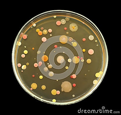 Different bacterial colonies on petri dish isolated on black background Stock Photo