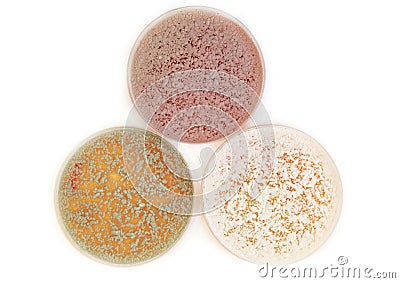 Different fungi microorganisms on agar plate Stock Photo