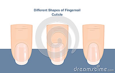 Different Shapes of Fingernail Cuticles. Manicure Guide. Vector Vector Illustration