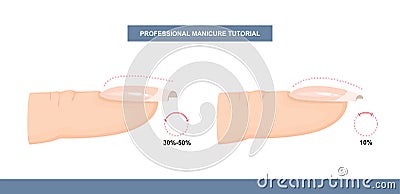 Different Shapes of Nail Plate. Side View. Nail Apex and C-curve. Professional Manicure Guide. Vector Vector Illustration