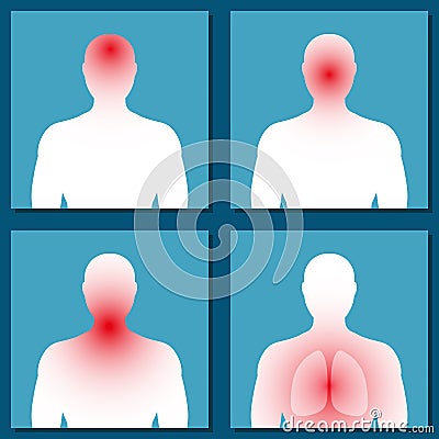 Different symptoms of colds, flu. Stage. Vector. Vector Illustration