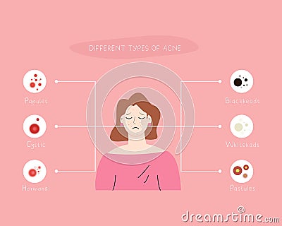 Different types of acne infographic illustration Vector Illustration
