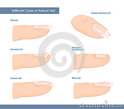 Different Types of Fingernail. Normal, Short, Roofed, Tubular, Arched, Flat, Convex and Concave Nails. Nail Extension Guide. Vector Illustration