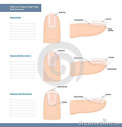 Different Types of Nail Plate. Normal, Convex and Concave Nails. Nail Extension Guide. Vector Vector Illustration