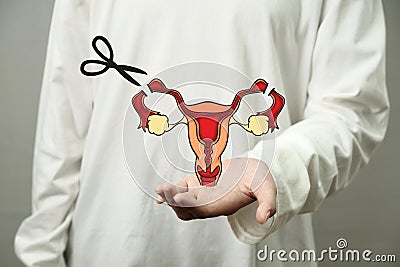 Digital illustration of female sterilization by tie and cut the fallopian tubes procedure, health and medical Cartoon Illustration