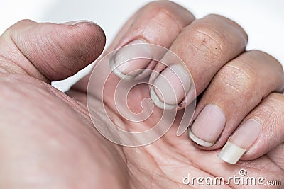 Dirty finger nails unhealthy pile up germ and bacteria unclean Stock Photo