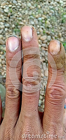 Dirty fingers, dirty long nails Stock Photo