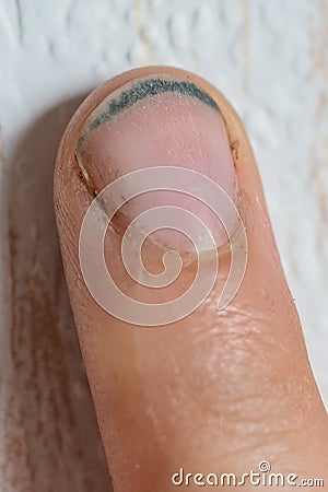 Dirty hand fingers thumb nails closeup Stock Photo