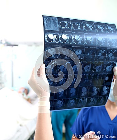 Discussion of CT scan in clinical ward Stock Photo