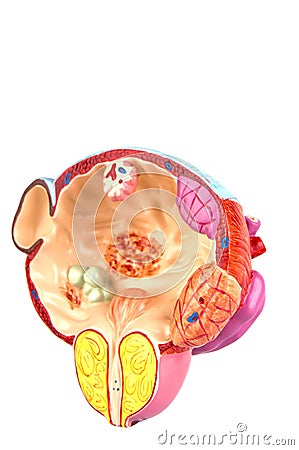 Disease of bladder & prostate symptoms Stock Photo