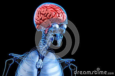 Diseased human brain. Anatomy concpet. 3D illustration Cartoon Illustration