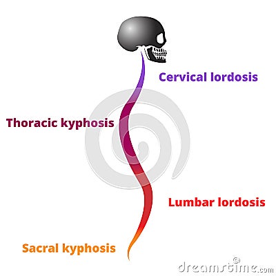 Diseases of the spine. Lordosis, kyphosis. Body posture defect. Realistic skull with a silhouette of the spine on white. Vector Illustration