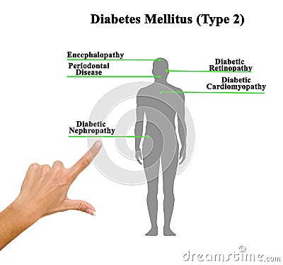 Disorders of Diabetes Mellitus Stock Photo