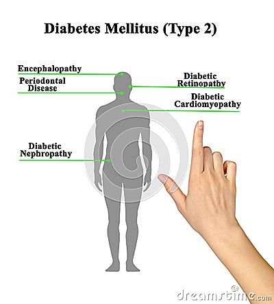 Disorders of Diabetes Mellitus Stock Photo