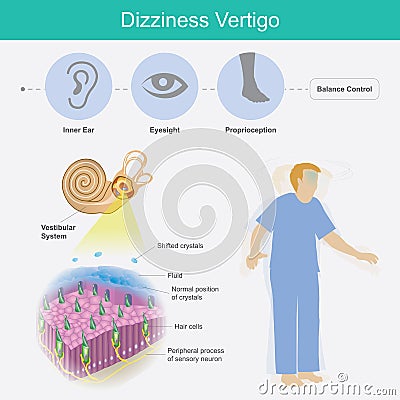 Dizziness Vertigo. Illustration explain dizziness Vector Illustration