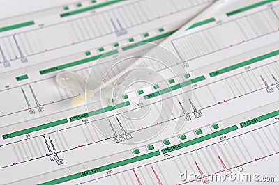 DNA Profile - Genetic Fingerprint Stock Photo