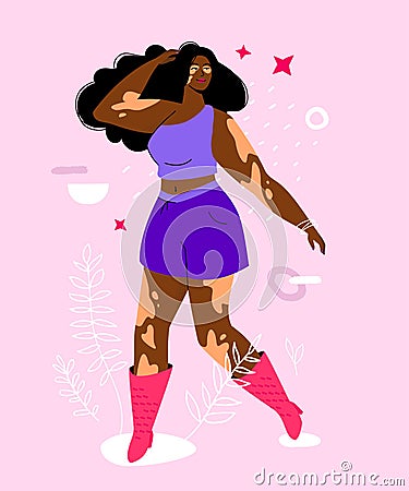 Do not be shy about vitiligo - colorful flat design style illustration Vector Illustration