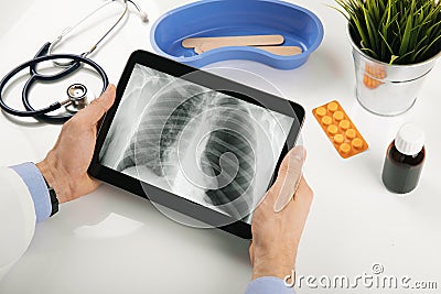 Doctor analyzing patient lung x-ray results on digital tablet Stock Photo