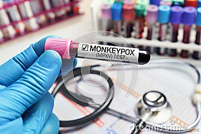 Doctor with a blood sample in a tube diagnosed with Monkeypox MPXV disease Stock Photo