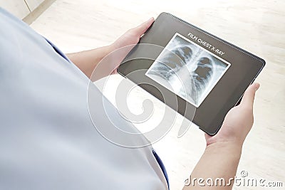 The doctor checked the Film chest X-ray via his tablet in the hospital Stock Photo