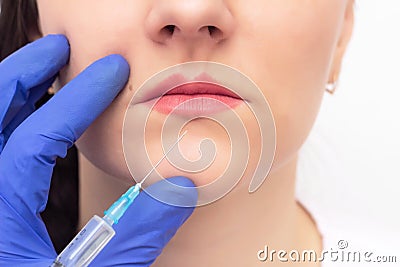 Doctor cosmetologist conducts a procedure to increase the volume of women`s lips with the help of injection of hyaluronic acid Stock Photo