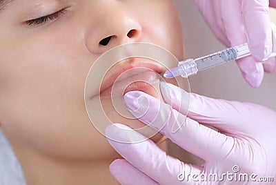 The doctor cosmetologist makes Lip augmentation procedure of a beautiful woman in a beauty salon Stock Photo