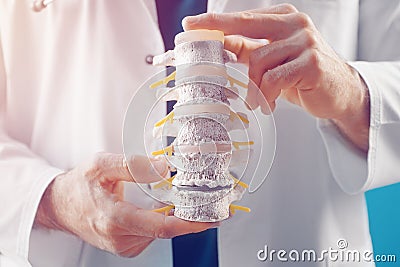 The doctor demonstrates the departments of the spine vertebrae, hernia and its injuries in the medical office Stock Photo