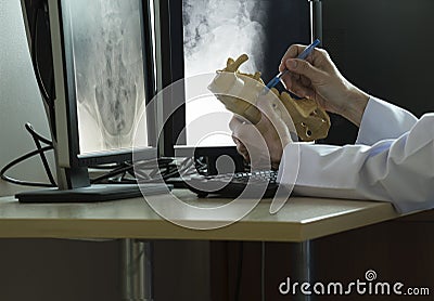 Doctor demonstrating lumbar spine model Stock Photo