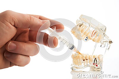 Dental anesthesia concept, close-up Stock Photo