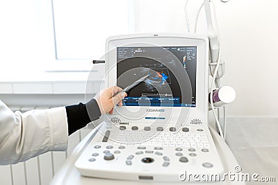 The doctor discusses the results of the ultrasound study with the patient. Pointing the pen to the monitor Editorial Stock Photo