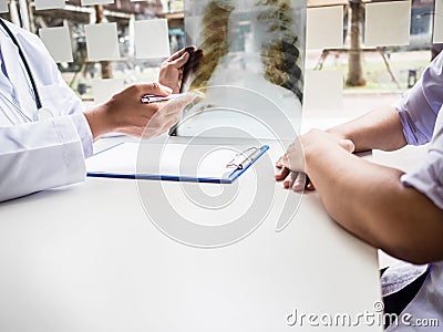 Doctor evaluated the chest x-ray and advise patients on health care Stock Photo