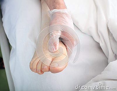 Doctor examines foot with edema Stock Photo