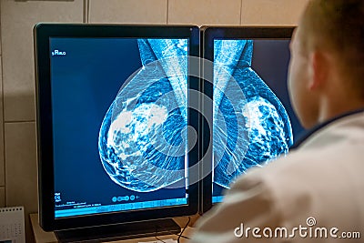 Doctor examines mammogram snapshot of breast of female patient on the monitors. Selective focus. Stock Photo