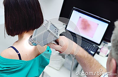 The doctor examines neoplasms or moles on the patient`s skin Stock Photo