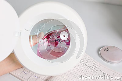 The doctor examines the petri dish under the magnifier, close-up Stock Photo