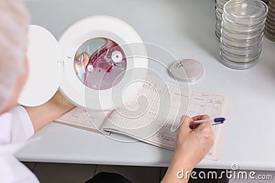 The doctor examines the petri dish under the magnifier, close-up Stock Photo