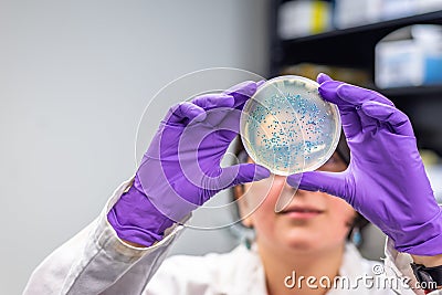 Doctor examining meningococcal bacterial culture plate Stock Photo