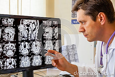 Doctor examining an MRI scan of the Brain Stock Photo