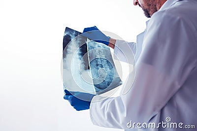 Doctor examining x-ray of the human spine Stock Photo