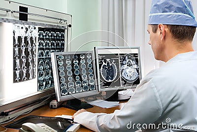 Doctor examining x-ray images Stock Photo