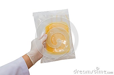 Doctor hand grab the blood plasma transfusion Stock Photo