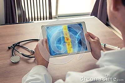 Doctor holding a digital tablet with x-ray of chest and pain on the spine Stock Photo