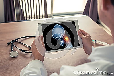 Doctor holding a digital tablet with x-ray of skull head and pain in the neck. Migraine and headache concept Stock Photo