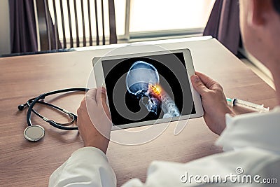 Doctor holding a digital tablet with x-ray of skull head and pain in the top of the neck. Migraine and headache concept Stock Photo