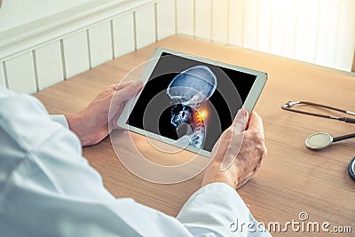 Doctor holding a digital tablet with x-ray of skull. Pain on the neck. Migraine headache or trauma concept Stock Photo