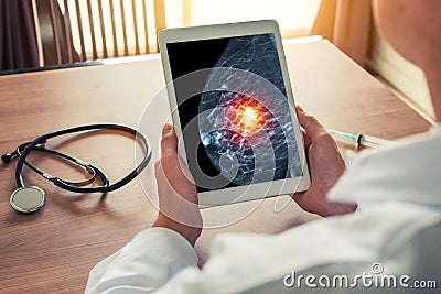 Doctor holding a digital tablet with xray mammogram skeleton. Breast cancer prevention Stock Photo