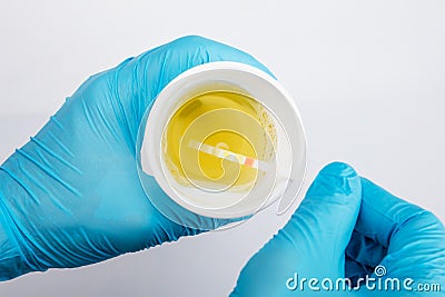 Doctor Holding Medical Urine Test In Clinic Stock Photo