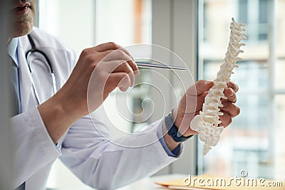 Doctor holding a model of a human spine Stock Photo