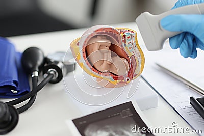 Doctor holding transducer for ultrasound examination in front of artificial model of human fetus in uterus closeup Stock Photo