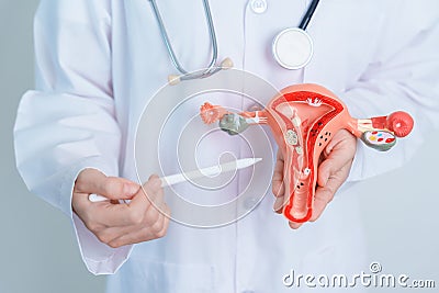 Doctor holding Uterus and Ovaries model. Ovarian and Cervical cancer, Cervix disorder, Endometriosis, Hysterectomy, Uterine Stock Photo